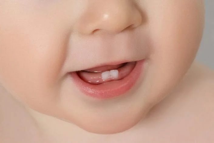 Bé chậm mọc răng