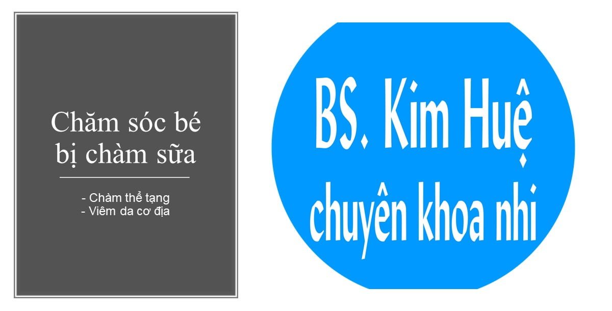 điều trị chàm sữa trẻ em