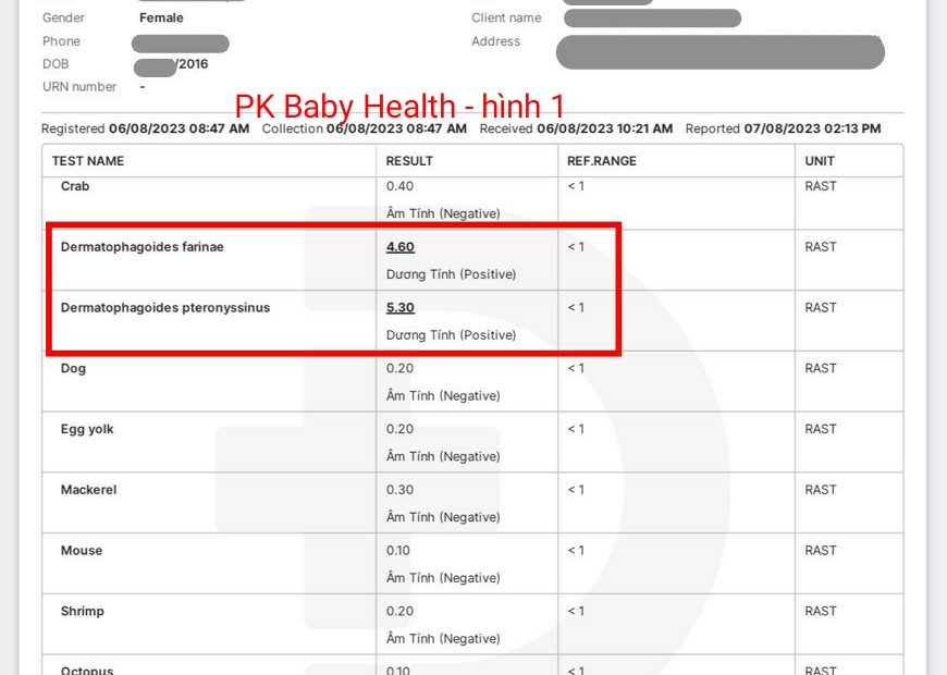 Bé dị ứng con mạt nhà / 1 / BS Kim Huệ
